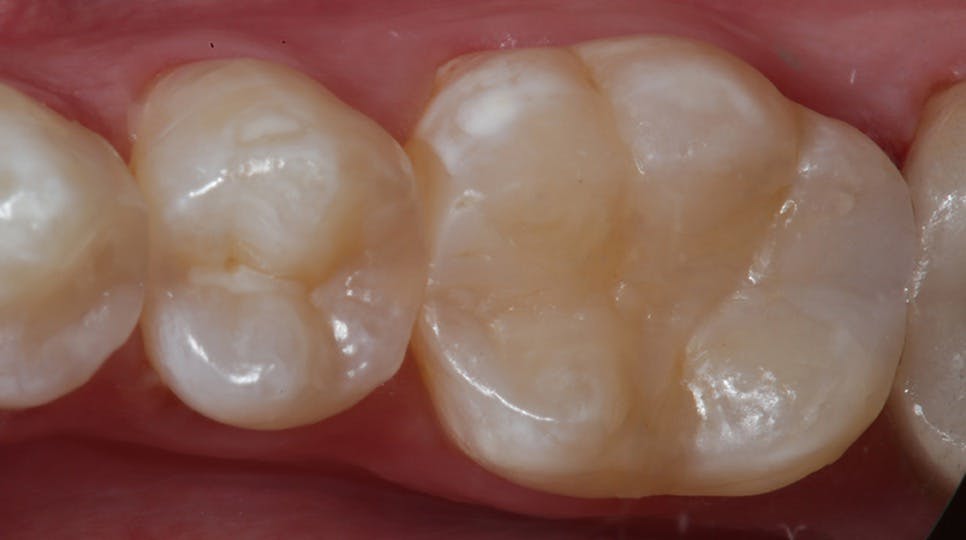 Operatif diş hekimliği nasıl keyifli, öngörülebilir ve üretken hale getirilir?